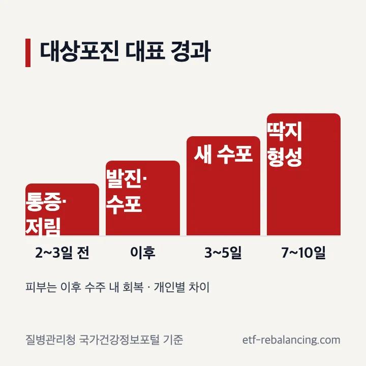 대상포진의 통증부터 수포와 딱지까지 대표 증상 흐름