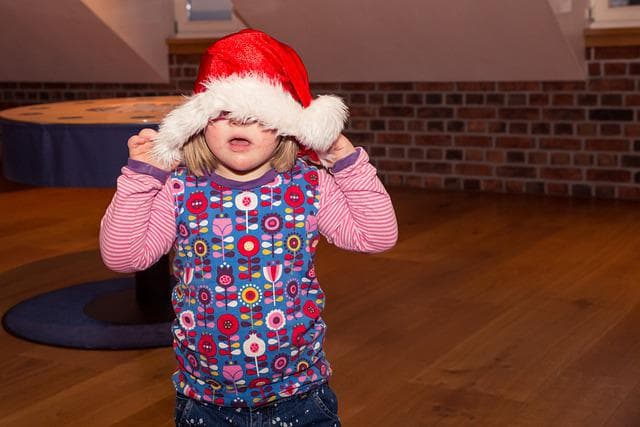 다운 증후군 수명 1