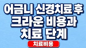 어금니 신경치료 후 크라운 비용과 치료 단계