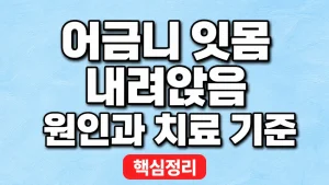 어금니 잇몸 내려앉음 원인과 치료 기준