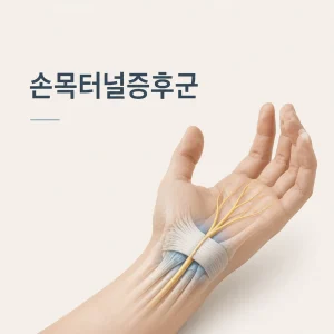 손목터널증후군 대표 이미지