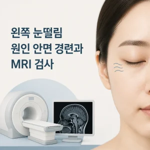왼쪽 눈떨림 원인 안면 경련과 MRI 검사 2 왼쪽 눈떨림 원인 대표 이미지