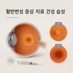 황반변성 증상 치료 건성 습성 8 황반변성 증상 치료 대표 이미지